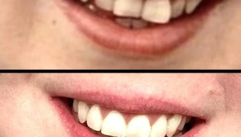 Alpen Dental Blackfalds - Blackfalds
